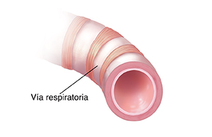 Corte transversal de un bronquiolo donde puede verse la vía respiratoria abierta.